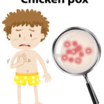 Can Chickenpox Result in Death in Older Adults?