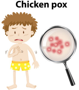 Can Chickenpox Result in Death in Older Adults? azelders.com